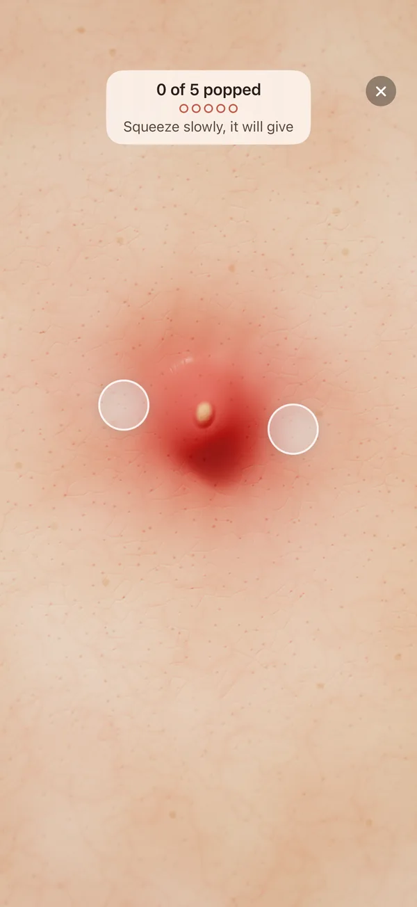 Pimple Pop: a practice game where you squeeze a bump on screen with two fingers